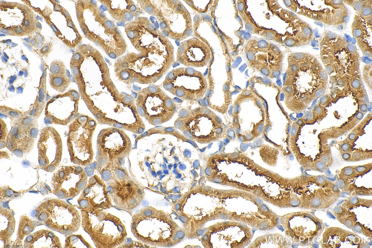 Immunohistochemistry (IHC) staining of mouse kidney tissue using SLC7A13 Polyclonal antibody (32002-1-AP)