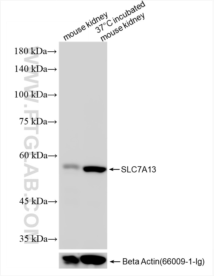 Western Blot (WB) analysis of various lysates using SLC7A13 Recombinant antibody (86078-1-RR)