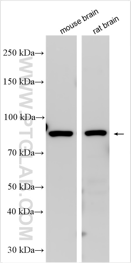 Western Blot (WB) analysis of various lysates using SLC7A2 Polyclonal antibody (30232-1-AP)