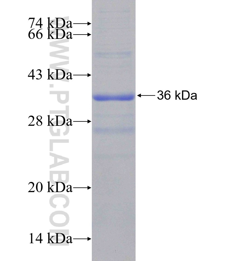 SLC7A2 fusion protein Ag31207 SDS-PAGE