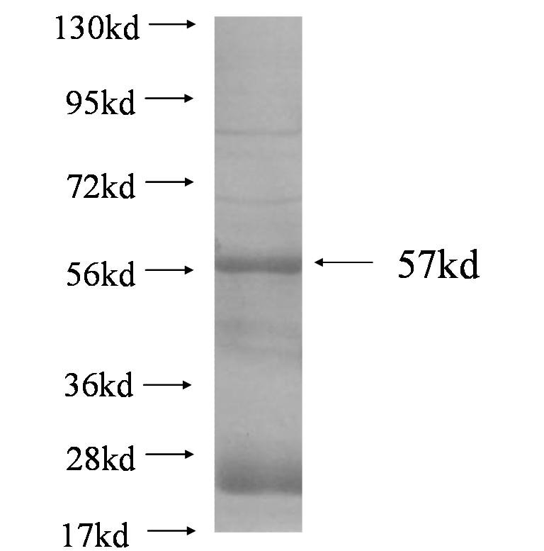 SLC7A3 fusion protein Ag4319 SDS-PAGE