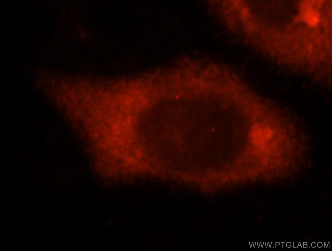 Immunofluorescence (IF) / fluorescent staining of HeLa cells using SLC7A4 Polyclonal antibody (15748-1-AP)