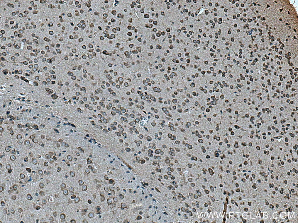 Immunohistochemistry (IHC) staining of mouse brain tissue using SLC7A4 Polyclonal antibody (15748-1-AP)