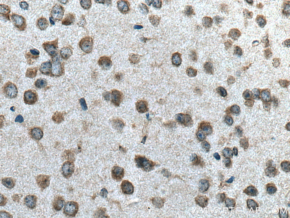 Immunohistochemistry (IHC) staining of mouse brain tissue using SLC7A4 Polyclonal antibody (15748-1-AP)