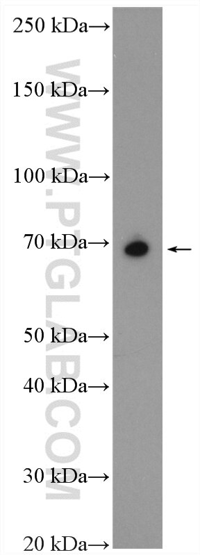 Western Blot (WB) analysis of mouse brain tissue using SLC7A4 Polyclonal antibody (15748-1-AP)