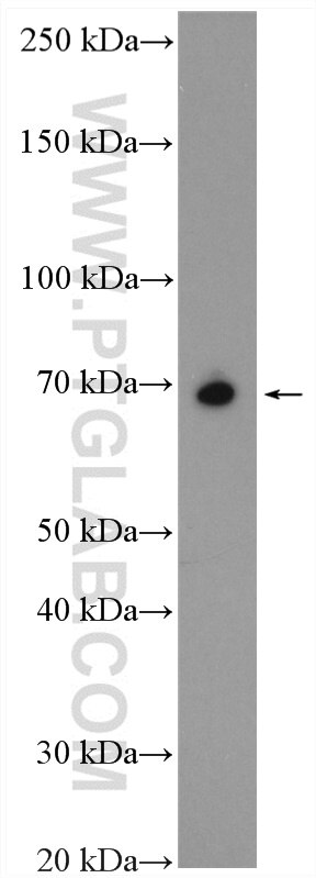 Western Blot (WB) analysis of mouse brain tissue using SLC7A4 Polyclonal antibody (15748-1-AP)