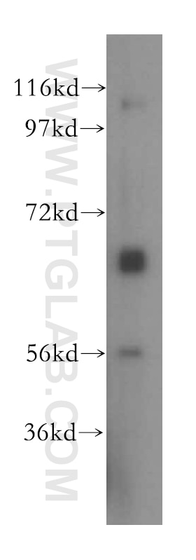 Western Blot (WB) analysis of human liver tissue using SLC7A4 Polyclonal antibody (15748-1-AP)