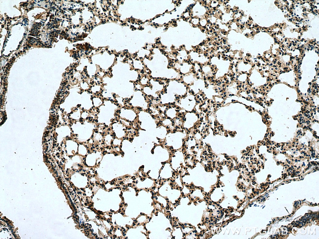 Immunohistochemistry (IHC) staining of mouse lung tissue using SLC7A5 Polyclonal antibody (13752-1-AP)