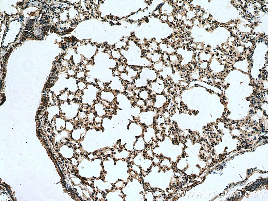 Immunohistochemistry (IHC) staining of mouse lung tissue using SLC7A5 Polyclonal antibody (13752-1-AP)