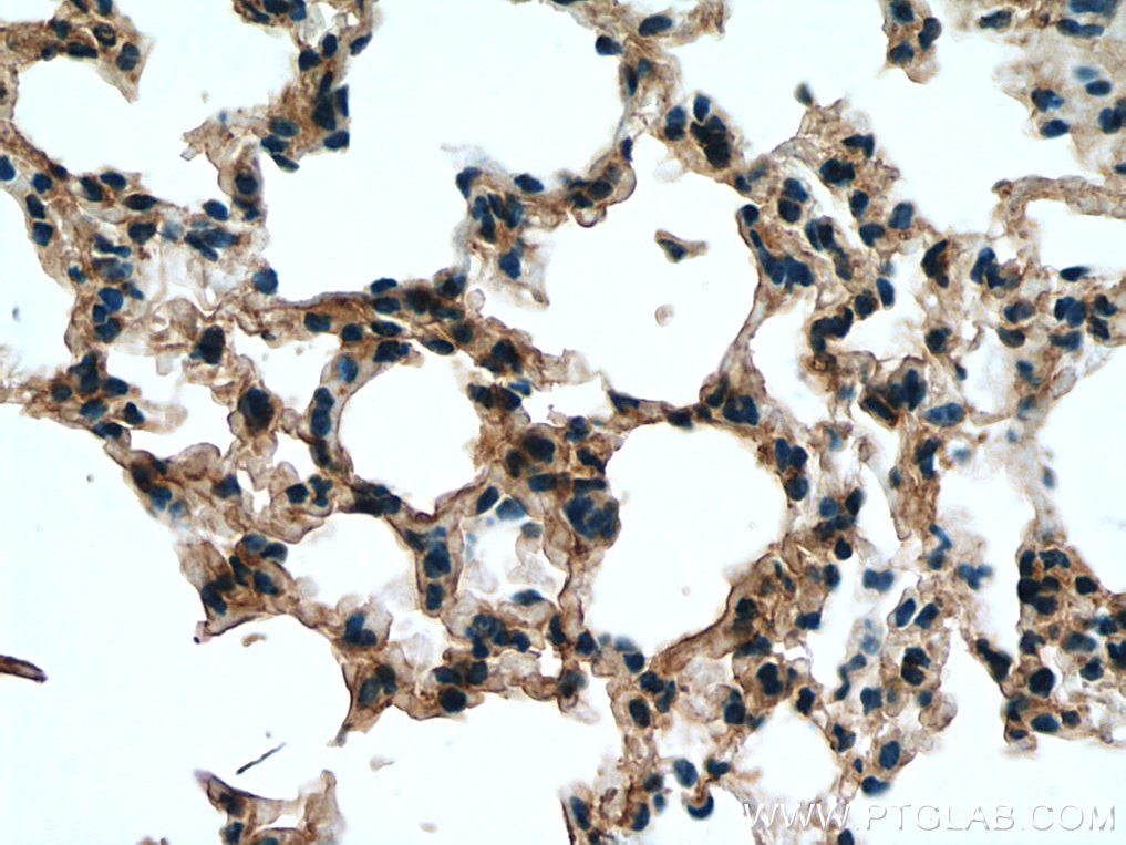 Immunohistochemistry (IHC) staining of mouse lung tissue using SLC7A5 Polyclonal antibody (13752-1-AP)