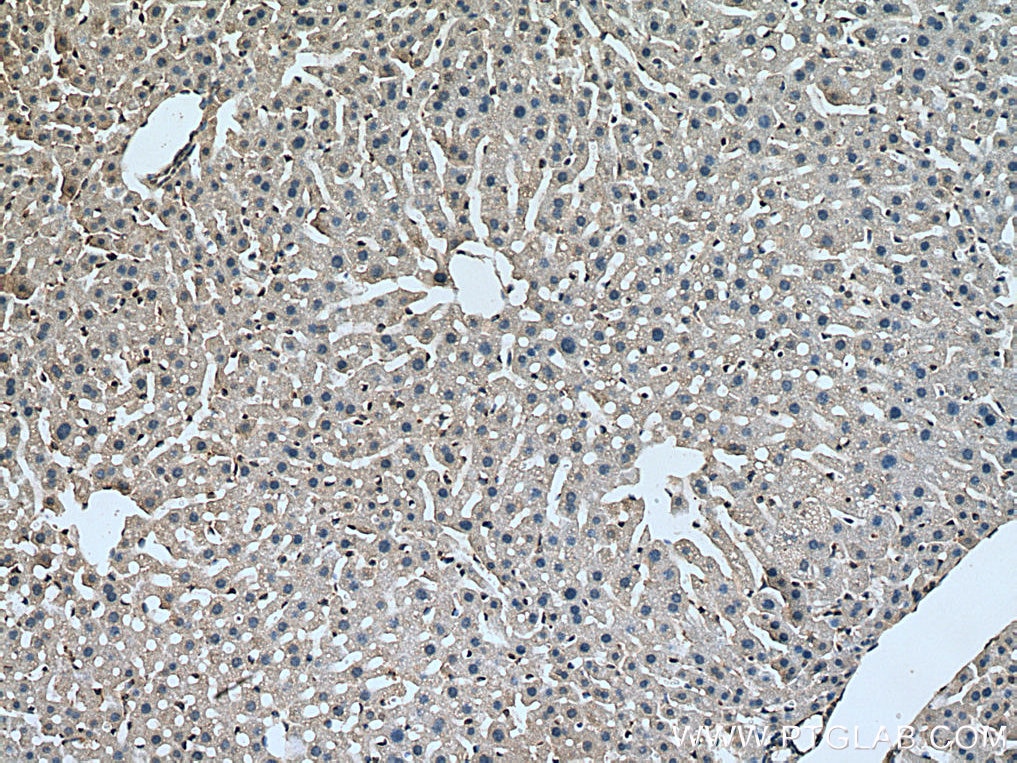 Immunohistochemistry (IHC) staining of mouse liver tissue using SLC7A5 Polyclonal antibody (13752-1-AP)