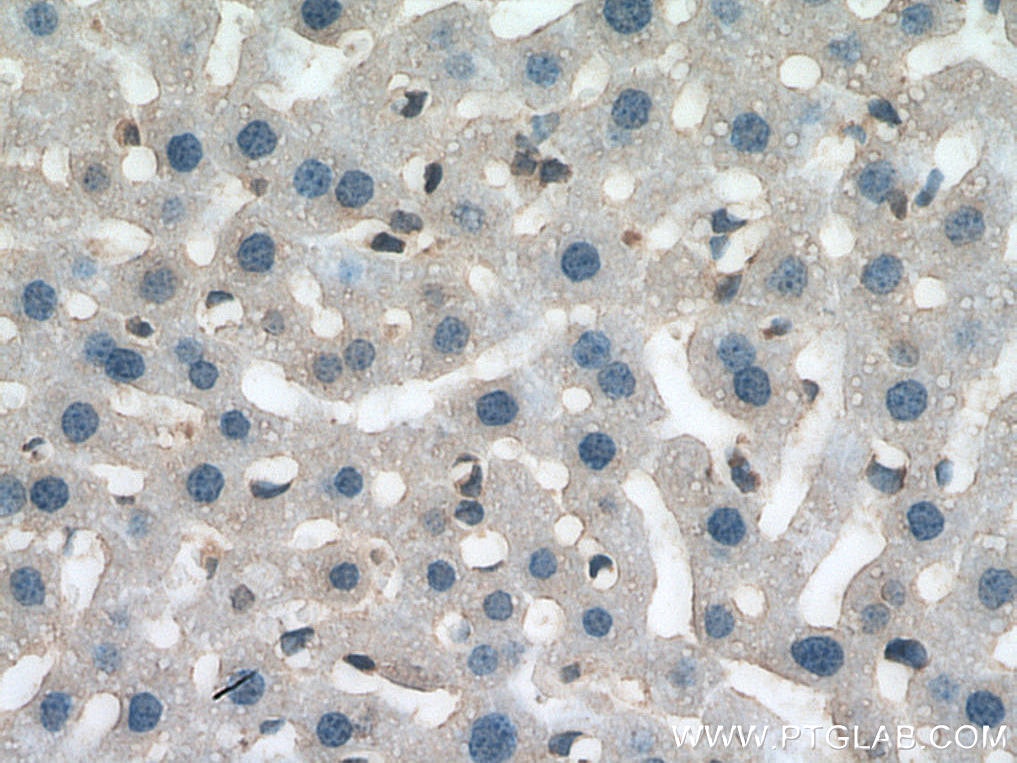 Immunohistochemistry (IHC) staining of mouse liver tissue using SLC7A5 Polyclonal antibody (13752-1-AP)