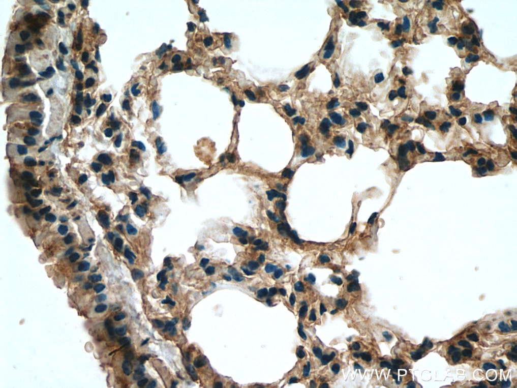 Immunohistochemistry (IHC) staining of mouse lung tissue using SLC7A5 Polyclonal antibody (13752-1-AP)