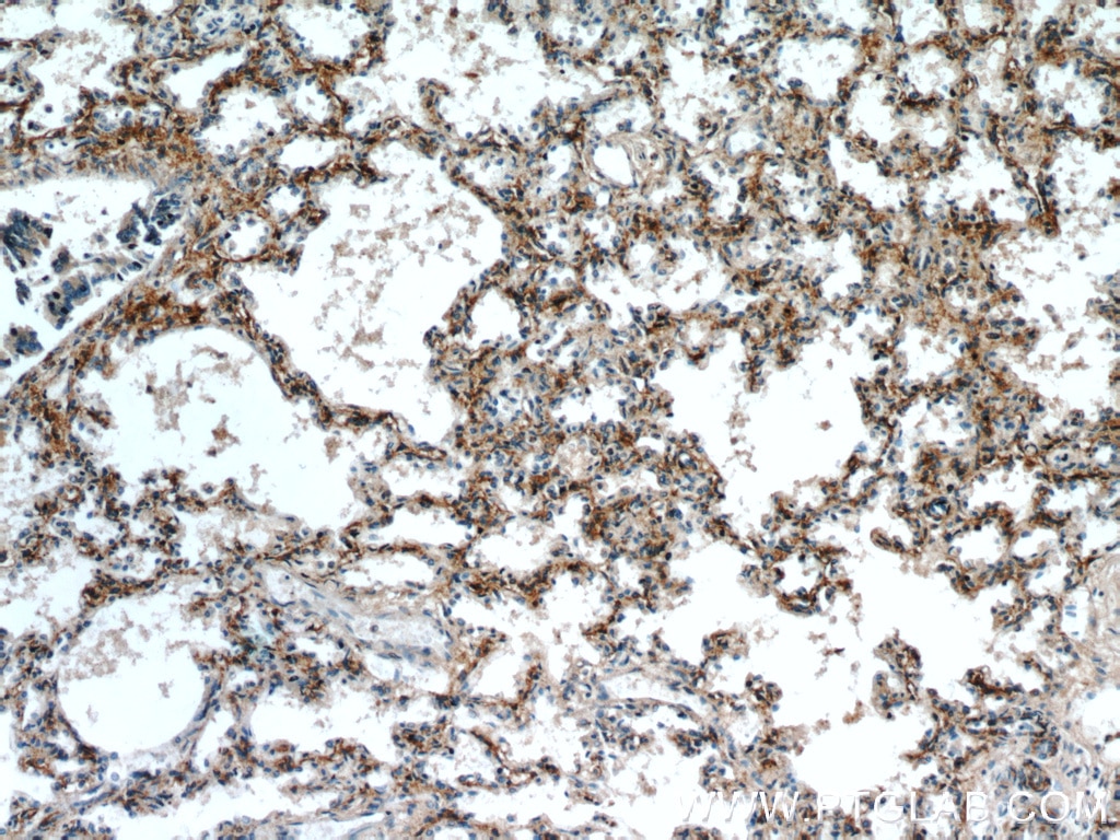 Immunohistochemistry (IHC) staining of human lung tissue using SLC7A5 Polyclonal antibody (13752-1-AP)