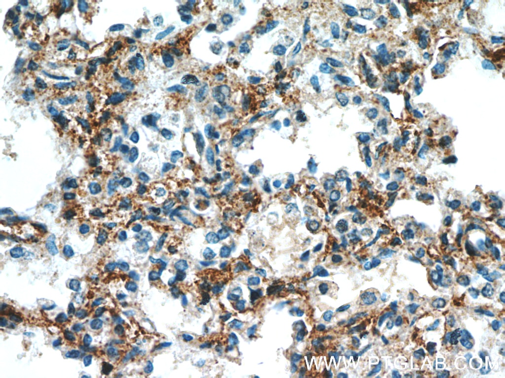 Immunohistochemistry (IHC) staining of human lung tissue using SLC7A5 Polyclonal antibody (13752-1-AP)