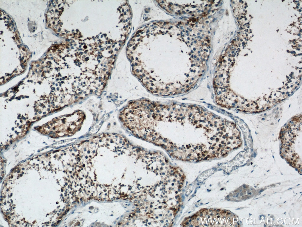 Immunohistochemistry (IHC) staining of human testis tissue using SLC7A5 Polyclonal antibody (13752-1-AP)