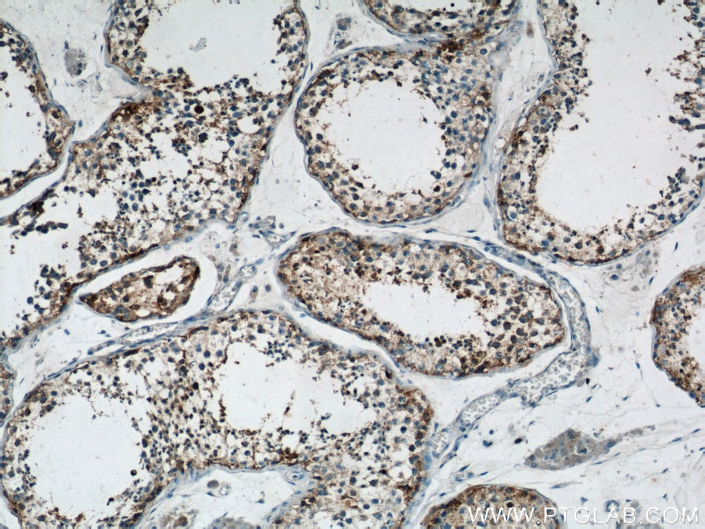 IHC staining of human testis using 13752-1-AP