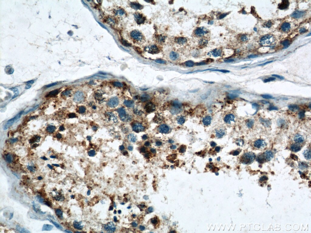 IHC staining of human testis using 13752-1-AP