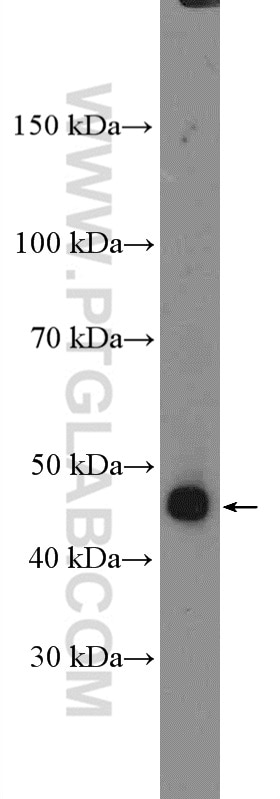 WB analysis of MCF-7 using 13752-1-AP