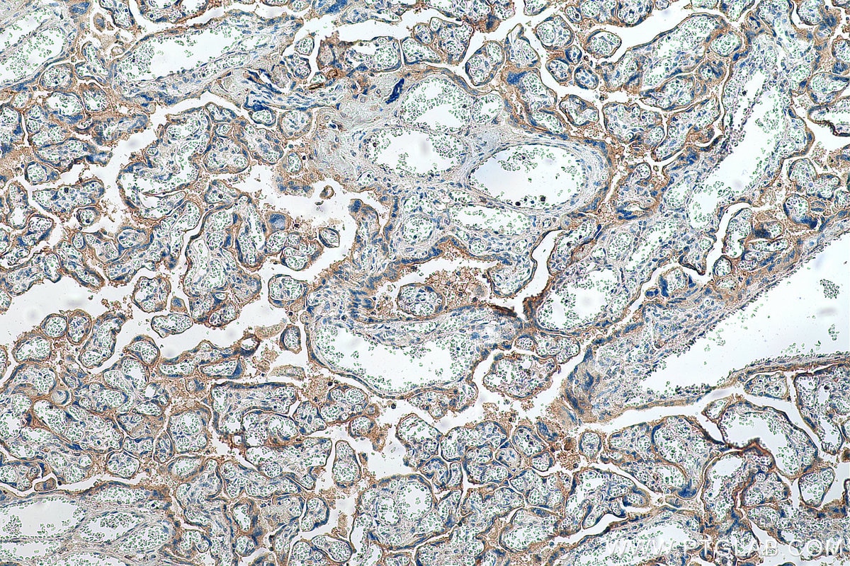 Immunohistochemistry (IHC) staining of human placenta tissue using SLC7A5 Polyclonal antibody (28670-1-AP)