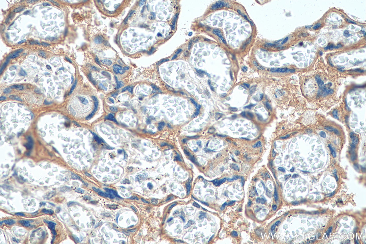 IHC staining of human placenta using 28670-1-AP