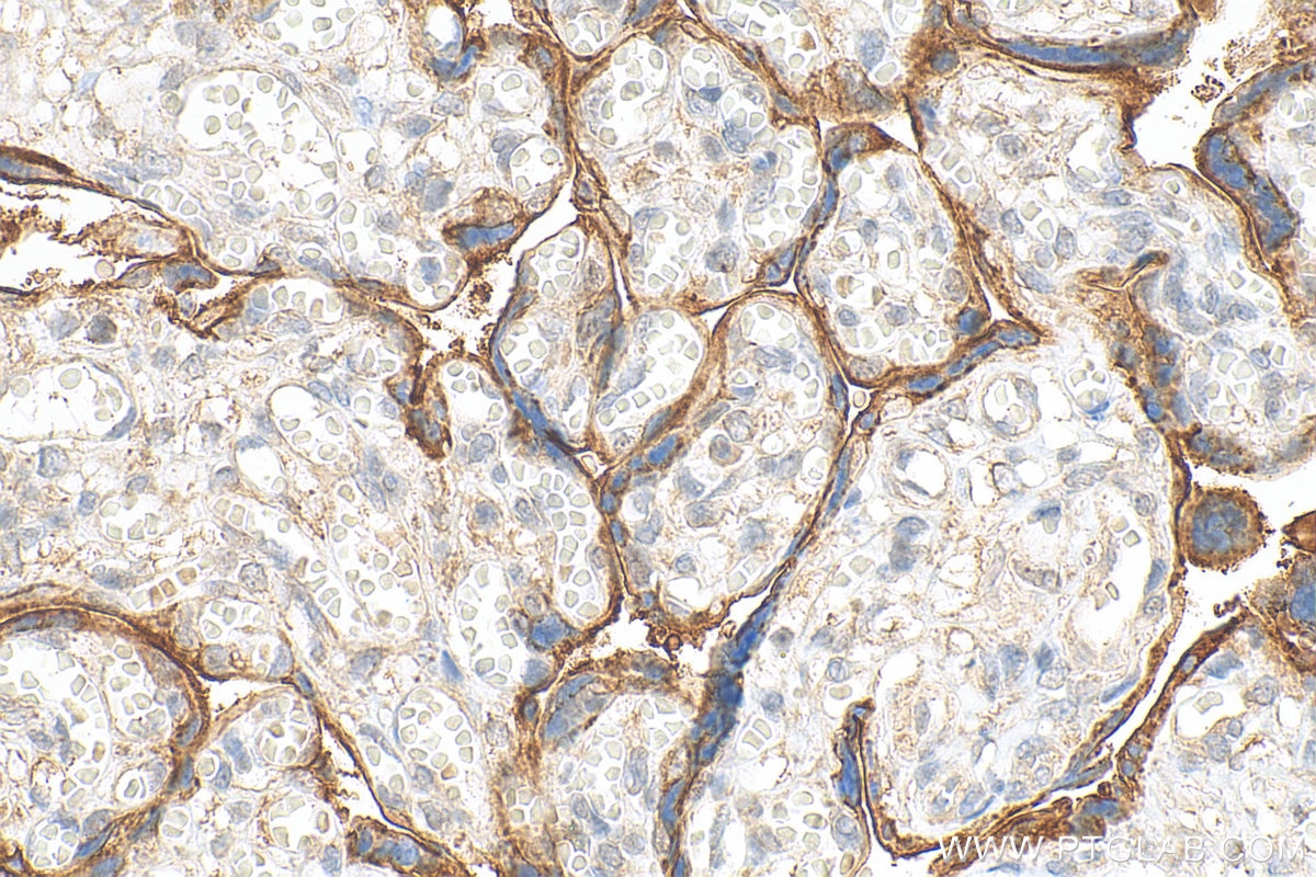 Immunohistochemistry (IHC) staining of human placenta tissue using SLC7A5 Polyclonal antibody (28670-1-AP)