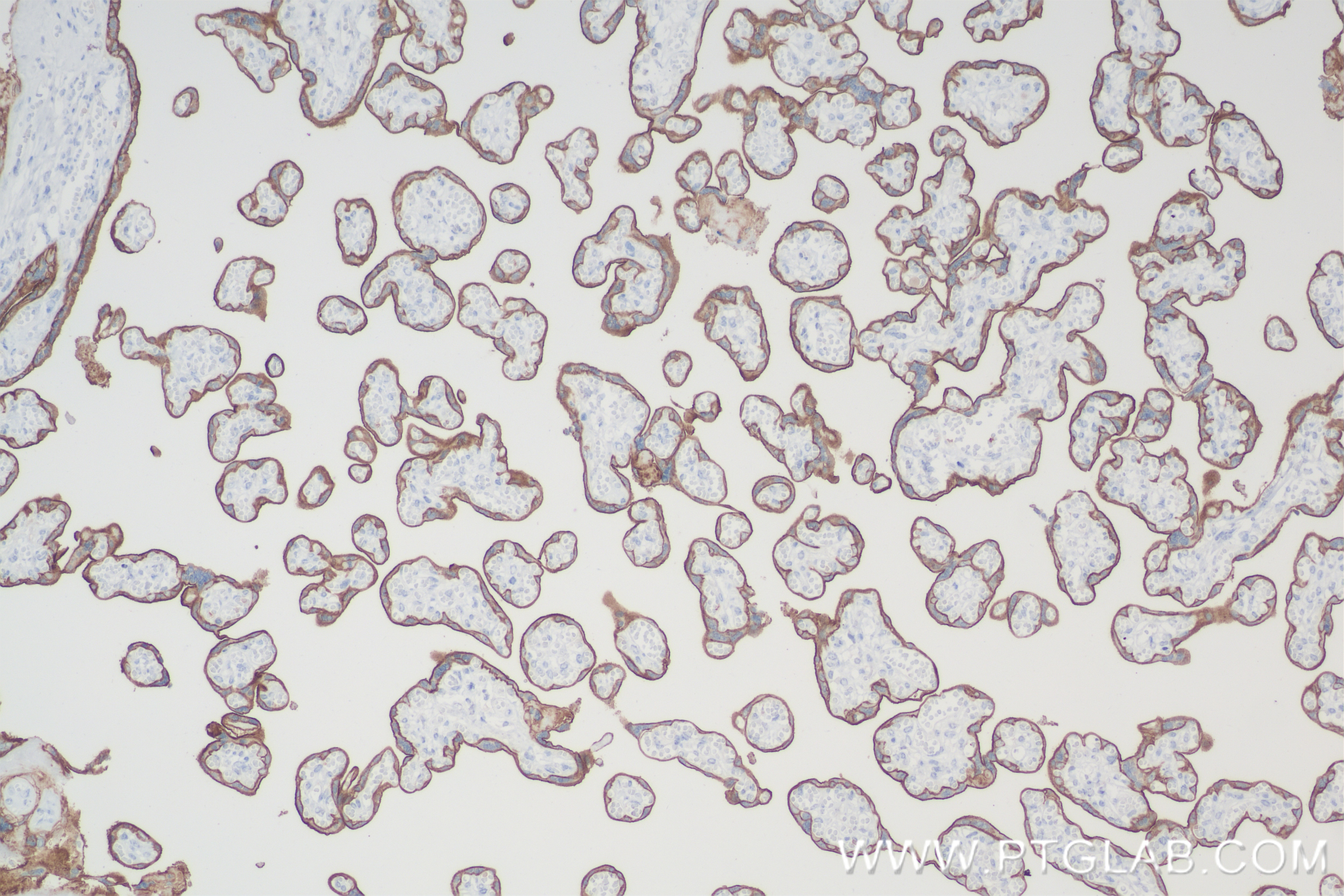 Immunohistochemistry (IHC) staining of human placenta tissue using SLC7A5 Recombinant antibody (84178-5-RR)