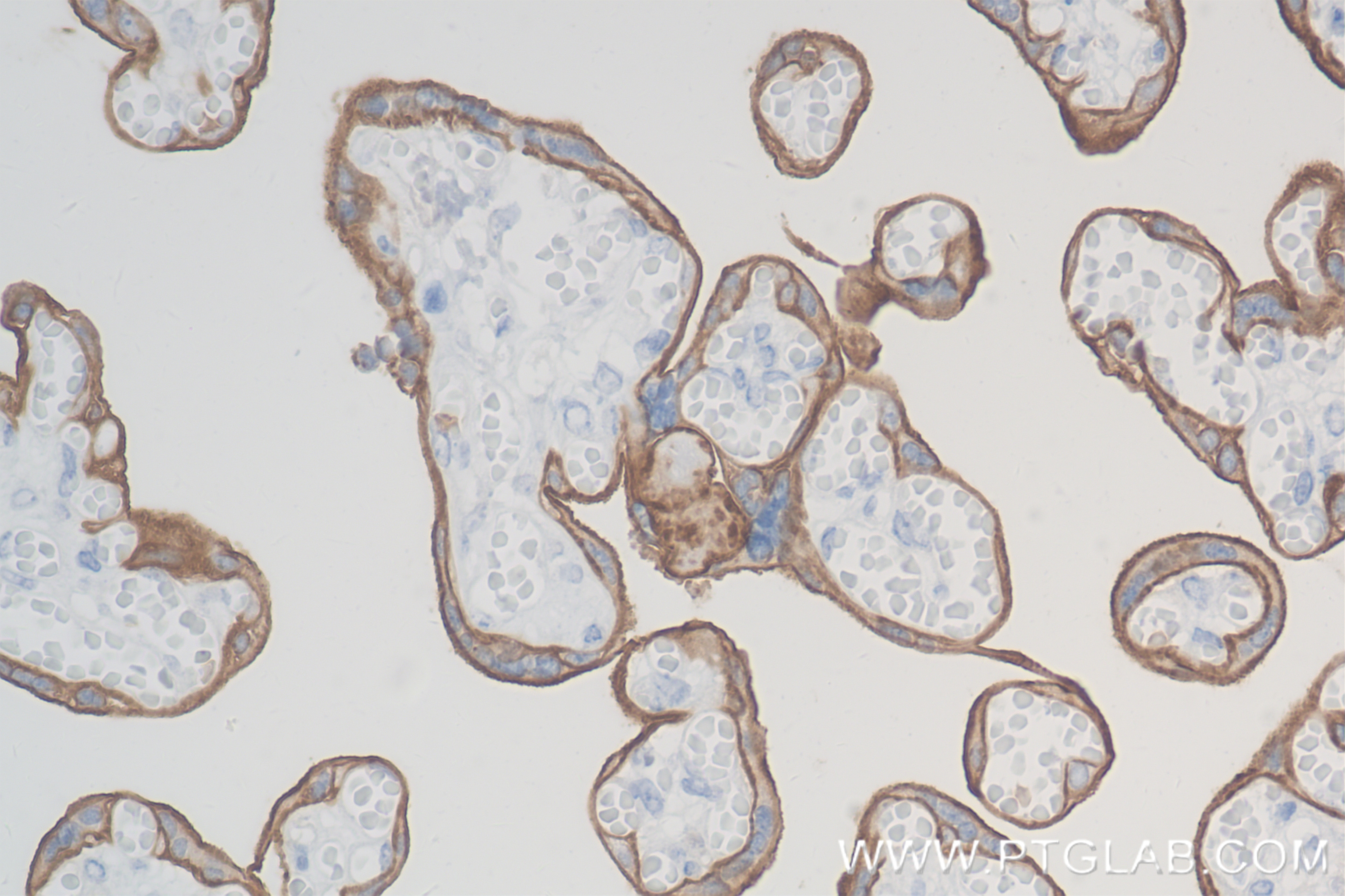 Immunohistochemistry (IHC) staining of human placenta tissue using SLC7A5 Recombinant antibody (84178-5-RR)