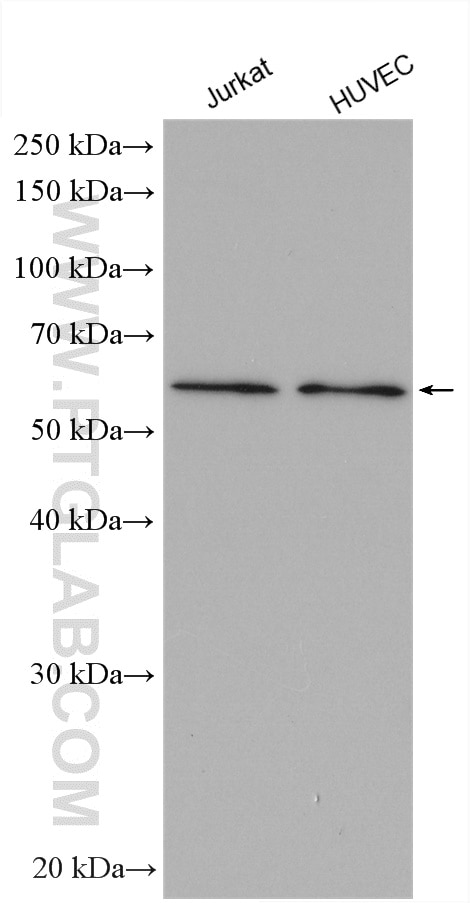 Western Blot (WB) analysis of various lysates using SLC7A6 Polyclonal antibody (13823-1-AP)