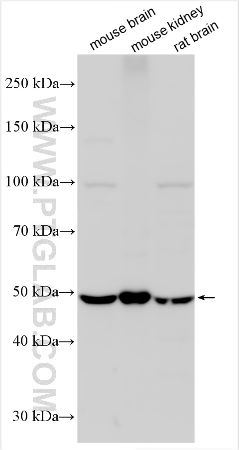 Western Blot (WB) analysis of various lysates using SLC7A7 Polyclonal antibody (26403-1-AP)
