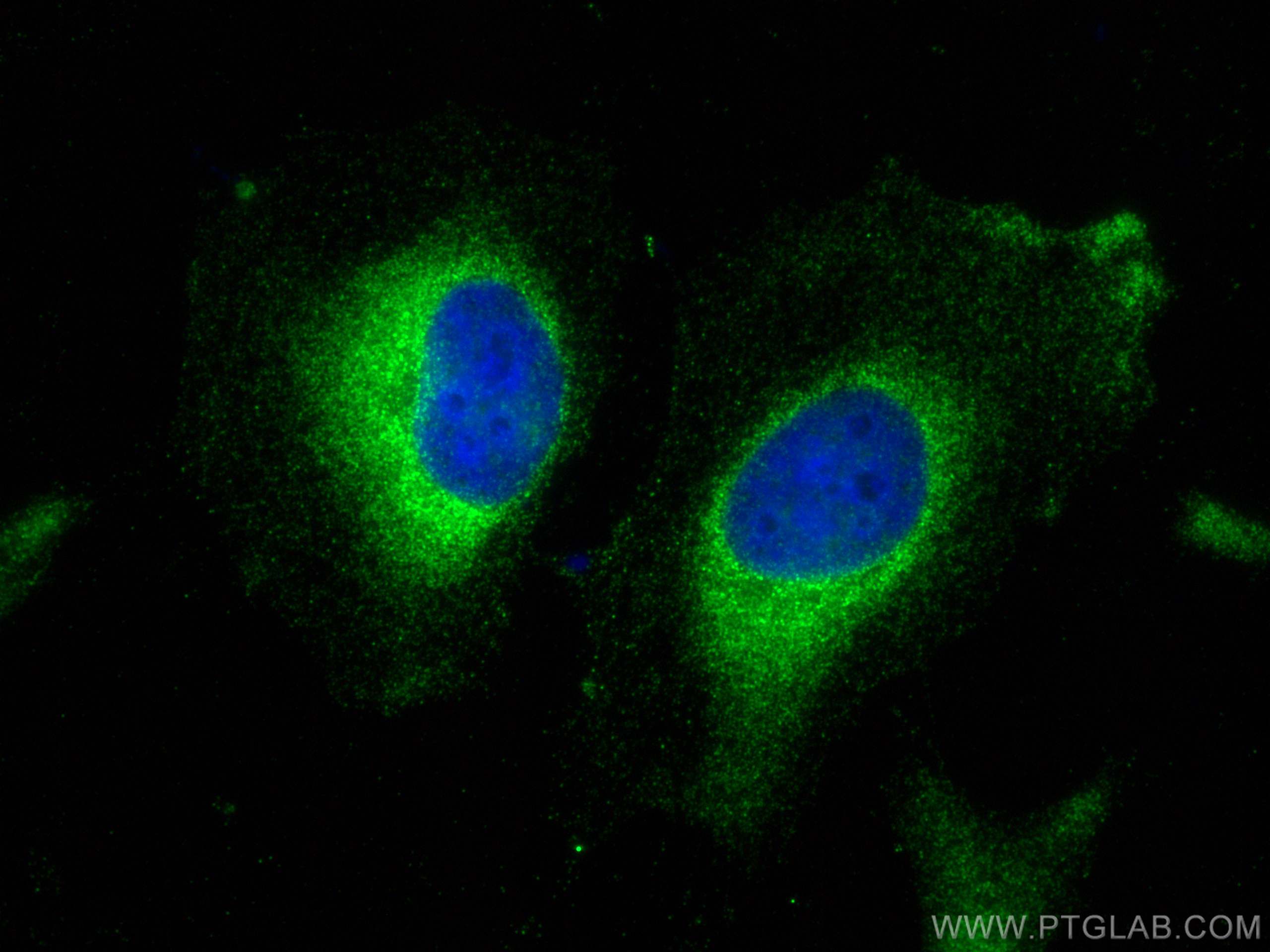 Immunofluorescence (IF) / fluorescent staining of HeLa cells using SLC7A8 Polyclonal antibody (30211-1-AP)