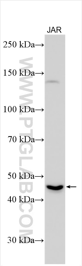 Western Blot (WB) analysis of various lysates using SLC7A8 Polyclonal antibody (30211-1-AP)