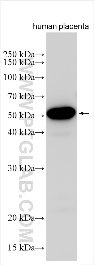 Western Blot (WB) analysis of various lysates using SLC7A8 Polyclonal antibody (30211-1-AP)