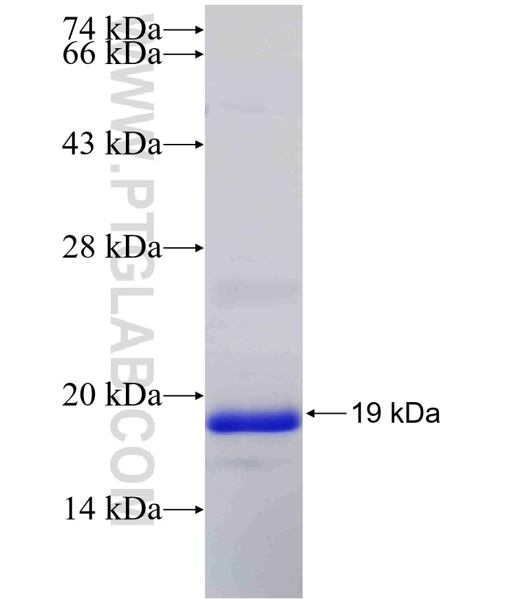 SLC7A9 fusion protein Ag31560 SDS-PAGE