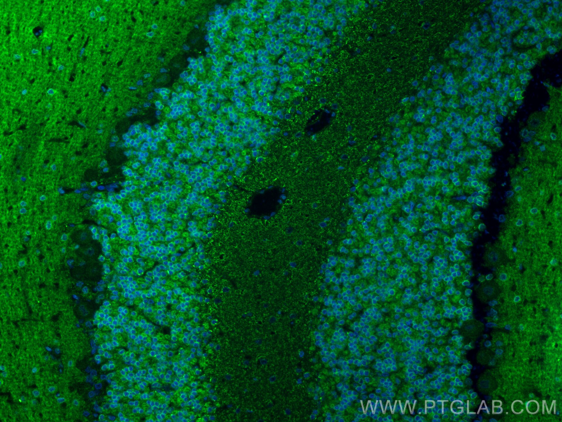 Immunofluorescence (IF) / fluorescent staining of rat cerebellum tissue using SLC8A2 Polyclonal antibody (31437-1-AP)