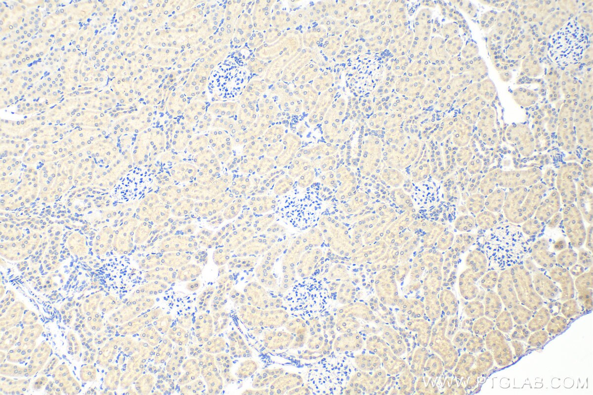 Immunohistochemistry (IHC) staining of rat kidney tissue using SLC8A2 Polyclonal antibody (31437-1-AP)