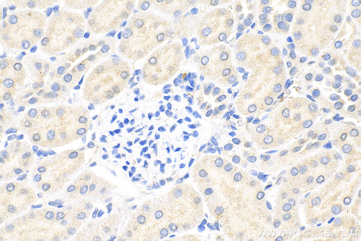 Immunohistochemistry (IHC) staining of rat kidney tissue using SLC8A2 Polyclonal antibody (31437-1-AP)