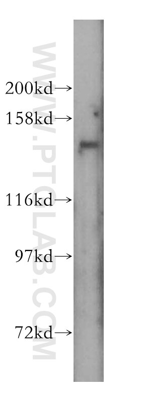 Western Blot (WB) analysis of mouse liver tissue using SLC9A11 Polyclonal antibody (17398-1-AP)