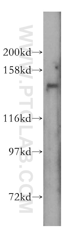 WB analysis of mouse liver using 17398-1-AP