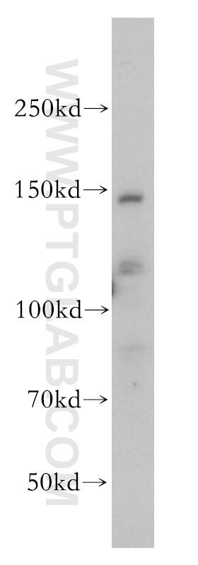 Western Blot (WB) analysis of HepG2 cells using SLC9A11 Polyclonal antibody (17398-1-AP)