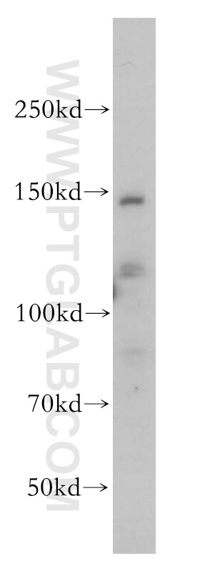 WB analysis of HepG2 using 17398-1-AP