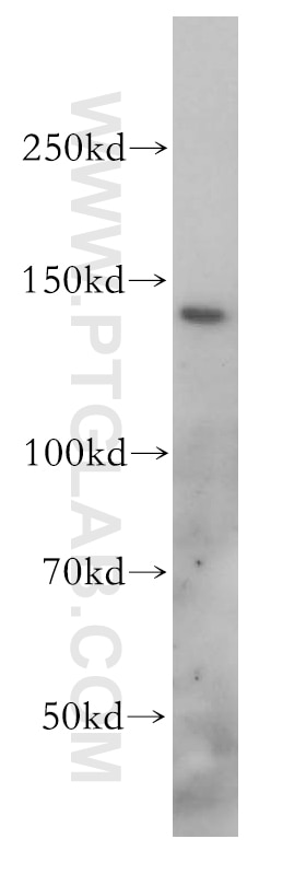 Western Blot (WB) analysis of mouse liver tissue using SLC9A11 Polyclonal antibody (17398-1-AP)