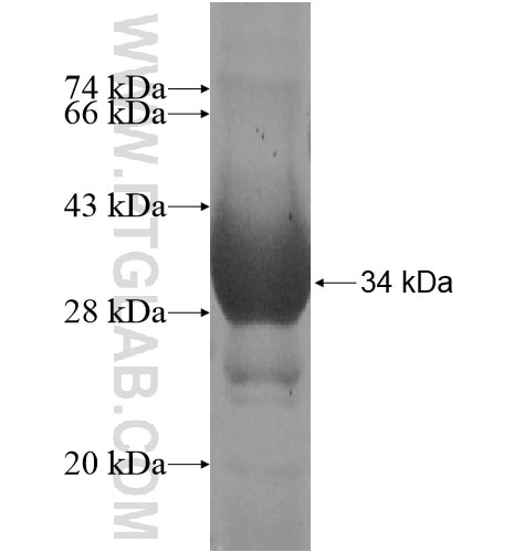 SLC9A11 fusion protein Ag11351 SDS-PAGE