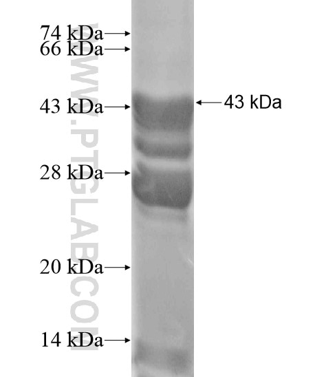 SLC9A2 fusion protein Ag18801 SDS-PAGE