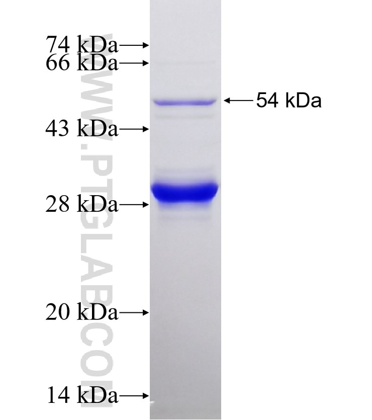 SLC9A3 fusion protein Ag25637 SDS-PAGE