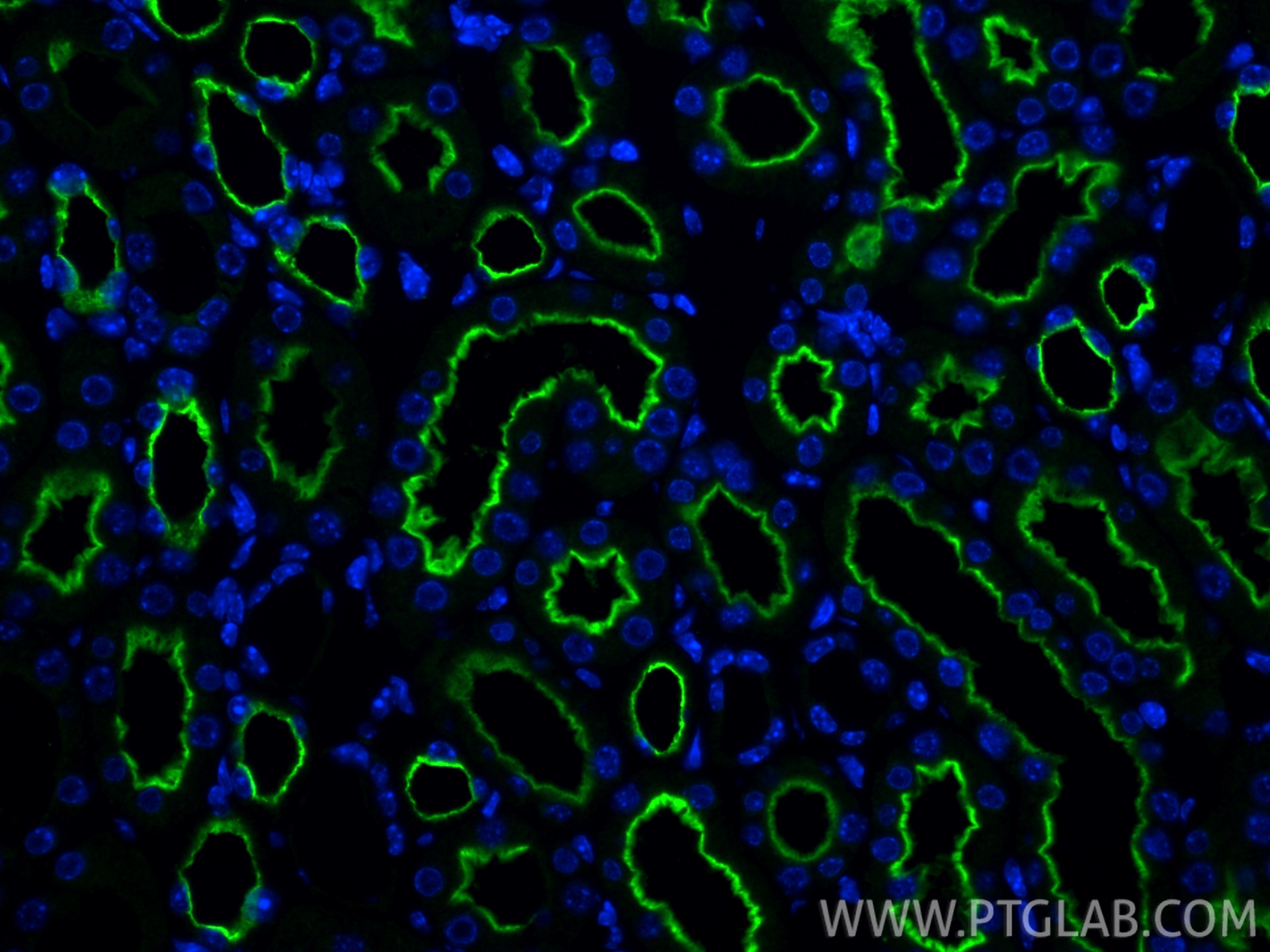 Immunofluorescent analysis of (4% PFA) fixed paraffin-embedded mouse kidney tissue using SLC9A3/NHE3 antibody (33559-1-AP) at dilution of 1:200 and CoraLite®488-Conjugated Goat Anti-Rabbit IgG(H+L) (SA00013-2). Heat mediated antigen retrieval with Tris-EDTA buffer (pH 9.0). Immunofluorescence (IF) / fluorescent staining of mouse kidney tissue using SLC9A3/NHE3 Polyclonal antibody (33559-1-AP)