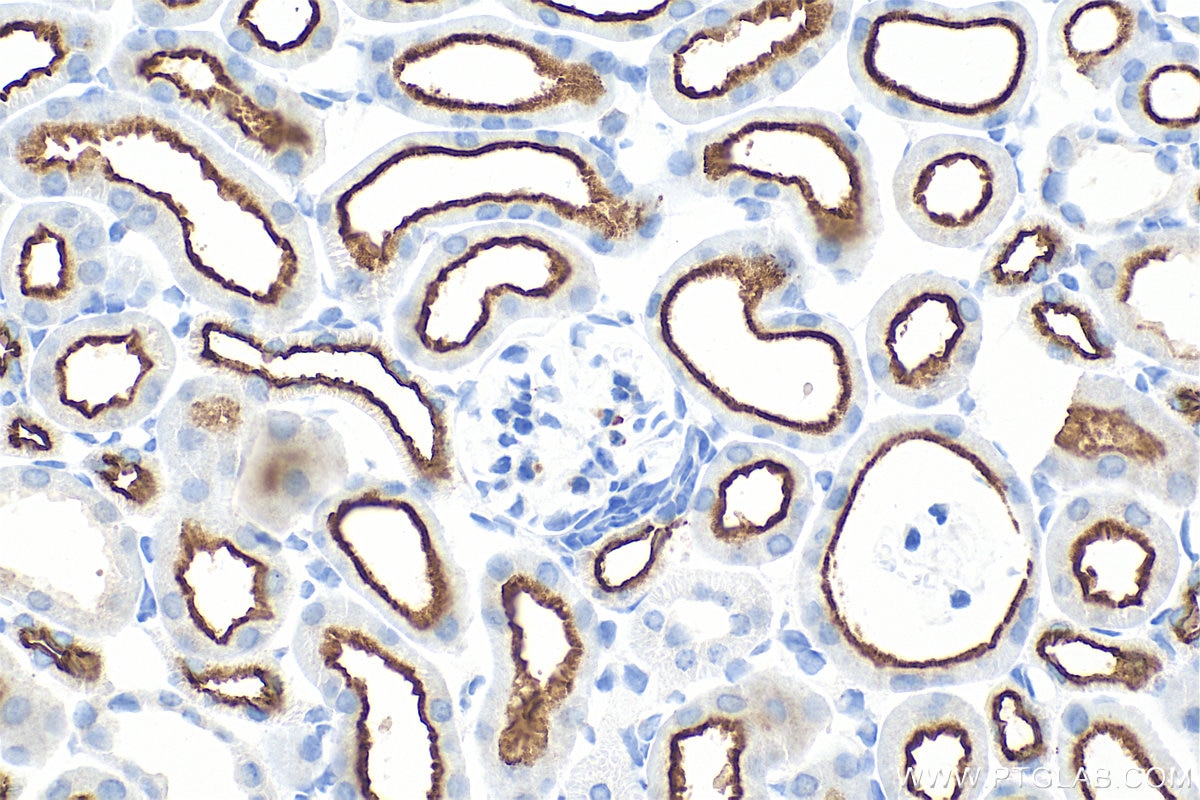 Immunohistochemical analysis of paraffin-embedded mouse kidney tissue slide using 33559-1-AP (SLC9A3/NHE3 antibody) at dilution of 1:2000 (under 40x lens). Heat mediated antigen retrieval with Tris-EDTA buffer (pH 9.0). Immunohistochemistry (IHC) staining of mouse kidney tissue using SLC9A3/NHE3 Polyclonal antibody (33559-1-AP)