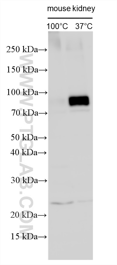 Various lysates were subjected to SDS PAGE followed by western blot with 33559-1-AP (SLC9A3/NHE3 antibody) at dilution of 1:1500 incubated at room temperature for 1.5 hours. Western Blot (WB) analysis of various lysates using SLC9A3/NHE3 Polyclonal antibody (33559-1-AP)