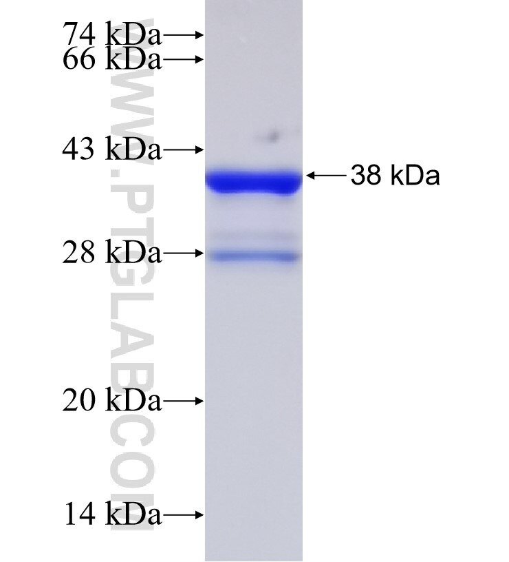 SLC9A3R1 fusion protein Ag30878 SDS-PAGE