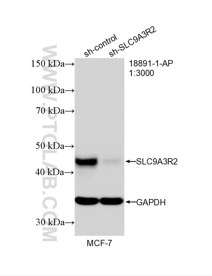Western Blot (WB) analysis of MCF-7 cells using SLC9A3R2 Polyclonal antibody (18891-1-AP)